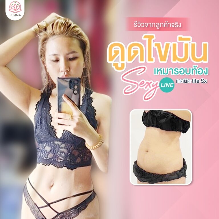 Phuma clinic (ภูม่า) พญ.ชลดา วิรัตกพันธ์ (ดูดไขมัน)